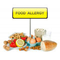 Хранителни алергии